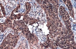 Invitrogen RAD51 Polyclonal Antibody 100 &mu;L; Unconjugated:Antibodies,