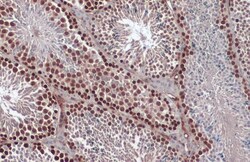 Invitrogen RAD51 Polyclonal Antibody 100 &mu;L; Unconjugated:Antibodies,