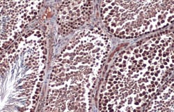 Invitrogen RAD51 Polyclonal Antibody 100 &mu;L; Unconjugated:Antibodies,