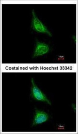 Invitrogen Aladin Polyclonal Antibody 100 &mu;L; Unconjugated:Antibodies,