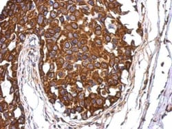 Invitrogen Aladin Polyclonal Antibody 100 &mu;L; Unconjugated:Antibodies,
