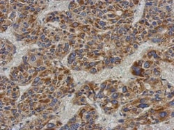 Invitrogen ACADL Polyclonal Antibody 100 &mu;L | Buy Online | Invitrogen&trade; | Fisher Scientific