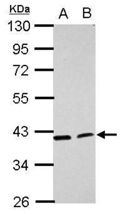 Invitrogen ACADL Polyclonal Antibody 100 &mu;L | Buy Online | Invitrogen&trade; | Fisher Scientific