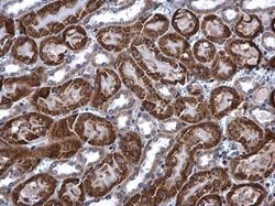 Invitrogen ACADM Polyclonal Antibody 100 &mu;L | Buy Online | Invitrogen&trade; | Fisher Scientific