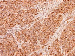 Invitrogen ACADM Polyclonal Antibody 100 &mu;L | Buy Online | Invitrogen&trade; | Fisher Scientific