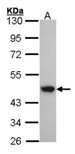 Invitrogen ACADM Polyclonal Antibody 100 &mu;L | Buy Online | Invitrogen&trade; | Fisher Scientific