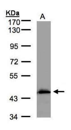 Invitrogen ACADM Polyclonal Antibody 100 &mu;L; Unconjugated:Antikroppar