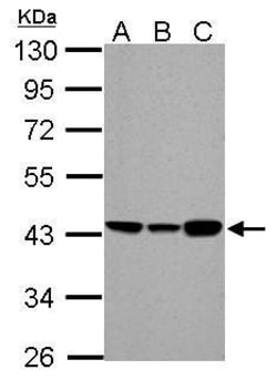 Invitrogen ACADM Polyclonal Antibody 100 &mu;L; Unconjugated:Antikroppar