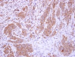 Invitrogen XIAP Polyclonal Antibody 100 &mu;L; Unconjugated:Antibodies,
