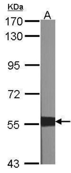 Invitrogen XIAP Polyclonal Antibody 100 &mu;L; Unconjugated:Antibodies,