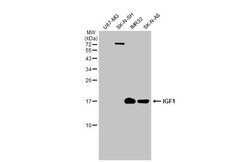 IGF1 Polyclonal Antibody, Invitrogen 100 &mu;L; Unconjugated:Antibodies,
