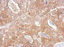 Invitrogen Kallikrein 2 Polyclonal Antibody 100 &mu;L; Unconjugated:Antibodies,
