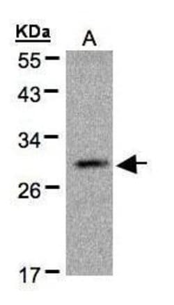 Invitrogen Kallikrein 2 Polyclonal Antibody 100 &mu;L; Unconjugated:Antibodies,