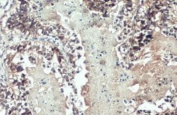 Invitrogen MMP1 Polyclonal Antibody 100 &mu;L; Unconjugated:Antibodies,