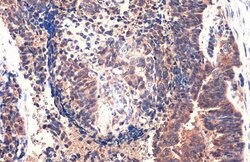 Invitrogen MMP1 Polyclonal Antibody 100 &mu;L; Unconjugated:Antibodies,