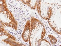 Invitrogen MVP Polyclonal Antibody 100 &mu;L; Unconjugated:Antibodies,