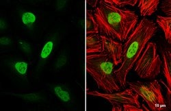 Invitrogen Rb Polyclonal Antibody 100 &mu;L; Unconjugated:Antibodies, Polyclonal
