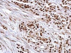 Invitrogen Rb Polyclonal Antibody 100 &mu;L; Unconjugated:Antibodies, Polyclonal