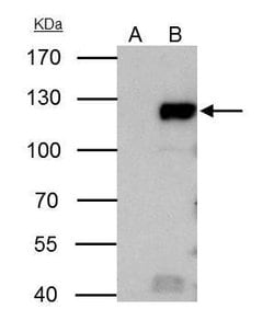 Invitrogen Rb Polyclonal Antibody 100 &mu;L; Unconjugated:Antibodies, Polyclonal