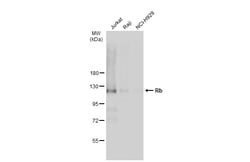 Invitrogen Rb Polyclonal Antibody 100 &mu;L; Unconjugated:Antibodies, Polyclonal