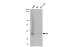 Invitrogen Rb Polyclonal Antibody 100 &mu;L; Unconjugated:Antibodies, Polyclonal