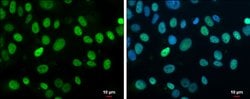 Invitrogen Rb Polyclonal Antibody 100 &mu;L; Unconjugated:Antibodies, Polyclonal