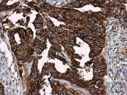Invitrogen VCAM-1 Polyclonal Antibody 100 &mu;L; Unconjugated:Antibodies,