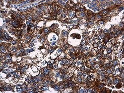 Invitrogen VCAM-1 Polyclonal Antibody 100 &mu;L; Unconjugated:Antibodies,