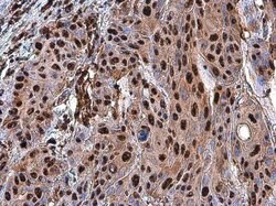 Invitrogen PARP1 Polyclonal Antibody 100 &mu;L; Unconjugated:Antibodies,