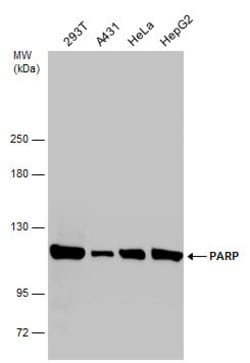 Invitrogen PARP1 Polyclonal Antibody 100 &mu;L; Unconjugated:Antibodies,