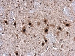 Invitrogen TDP-43 Polyclonal Antibody 100 &mu;L; Unconjugated:Antibodies,