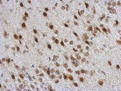 Invitrogen TDP-43 Polyclonal Antibody 100 &mu;L; Unconjugated:Antibodies,