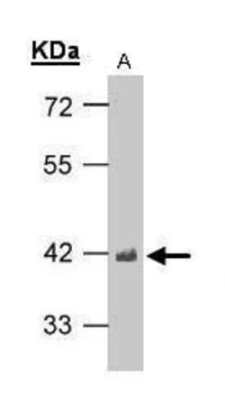 Invitrogen TDP-43 Polyclonal Antibody 100 &mu;L; Unconjugated:Antibodies,