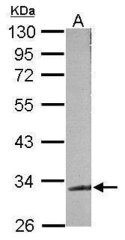 Invitrogen TDP-43 Polyclonal Antibody 100 &mu;L; Unconjugated:Antibodies,