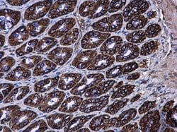 Invitrogen AGR3 Polyclonal Antibody 100 μL; Unconjugated:Antibodies,