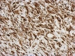 Invitrogen AGR3 Polyclonal Antibody 100 μL; Unconjugated:Antibodies,