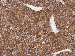 Invitrogen AGR3 Polyclonal Antibody 100 μL; Unconjugated:Antibodies,