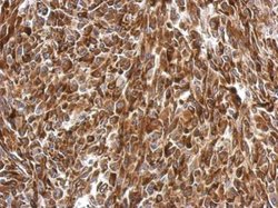 Invitrogen AGR3 Polyclonal Antibody 100 μL; Unconjugated:Antibodies,