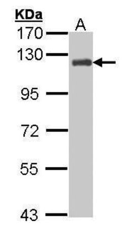 Invitrogen p130Cas Polyclonal Antibody 100 &mu;L | Buy Online | Invitrogen&trade; | Fisher Scientific