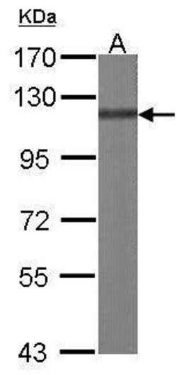 Invitrogen p130Cas Polyclonal Antibody 100 &mu;L | Buy Online | Invitrogen&trade; | Fisher Scientific