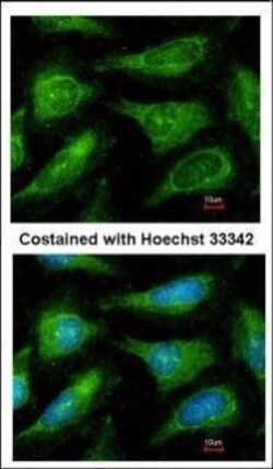 Invitrogen YES1 Polyclonal Antibody 100 &mu;L; Unconjugated:Antibodies,