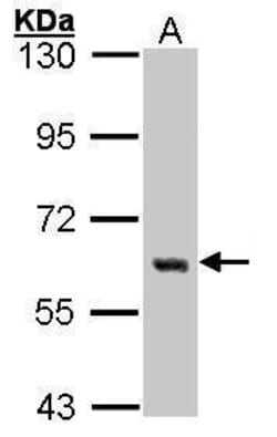 Invitrogen YES1 Polyclonal Antibody 100 &mu;L; Unconjugated:Antibodies,