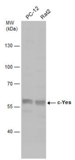 Invitrogen YES1 Polyclonal Antibody 100 &mu;L; Unconjugated:Antibodies,