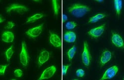 Invitrogen Vimentin Polyclonal Antibody 100 &mu;L; Unconjugated:Antibodies,