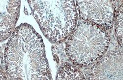 Invitrogen Vimentin Polyclonal Antibody 100 &mu;L; Unconjugated:Antibodies,