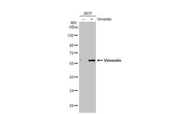 Invitrogen Vimentin Polyclonal Antibody 100 &mu;L; Unconjugated:Antibodies,