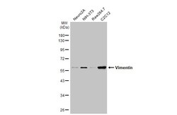 Invitrogen Vimentin Polyclonal Antibody 100 μL; Unconjugated:Antibodies,