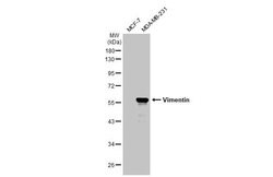 Invitrogen Vimentin Polyclonal Antibody 100 &mu;L; Unconjugated:Antibodies,