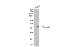 Invitrogen Vimentin Polyclonal Antibody 100 μL; Unconjugated:Antibodies,