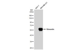 Invitrogen Vimentin Polyclonal Antibody 100 μL; Unconjugated:Antibodies,